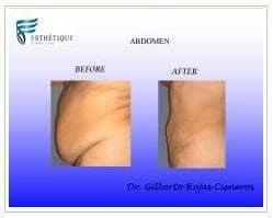 Slider image (3) Esthetique Clinic and Spa